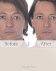 My Perfect Facial with 4x Dermaplaning Tools FREE - Deal of the Week!