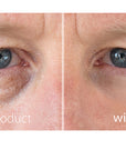 Today's Special: Add-on My Perfect Eyes to any order at HALF PRICE!