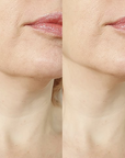 Labelle with 4x Dermaplaning Tools FREE - Deal of the Week!
