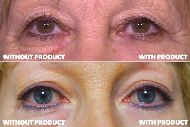 Worried About Wrinkles? Women Are Showing Off Staggering Results