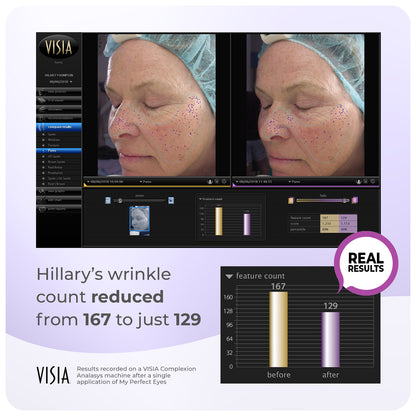 Double Deal TV Offer | My Perfect Facial + 2 x FREE Serum