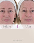 My Perfect Facial with 4x Dermaplaning Tools FREE - Deal of the Week!
