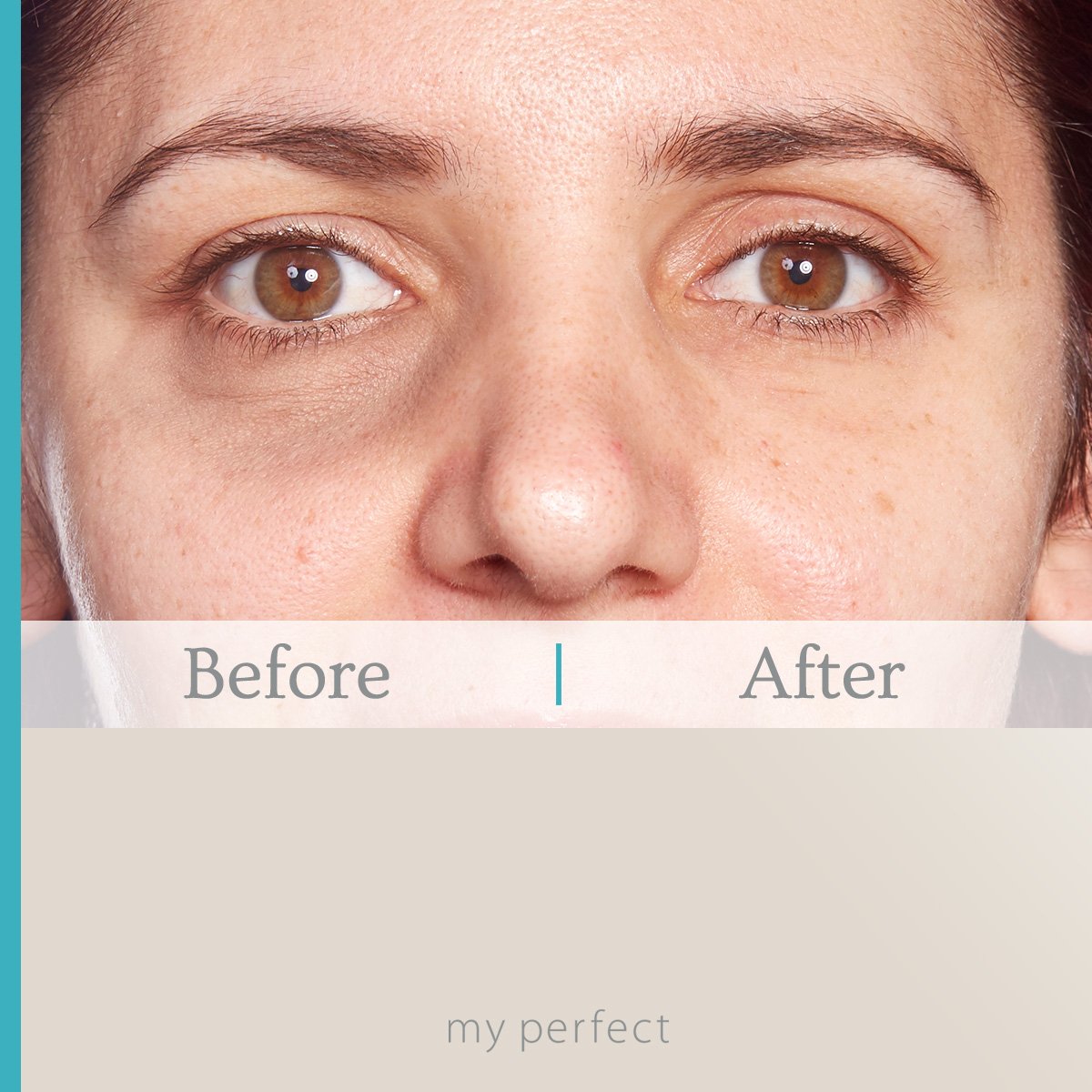 Today&#39;s Special: Add-on My Perfect Eyes to any order at HALF PRICE!